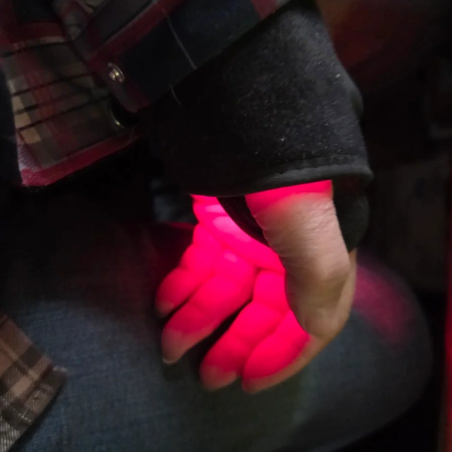 Foto de una clienta usando Munelux