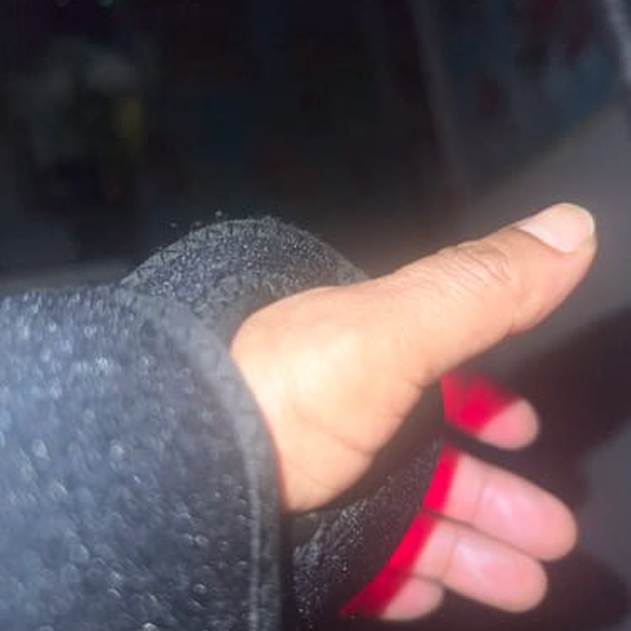 Foto de una clienta usando Munelux